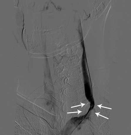 procedure1.jpg